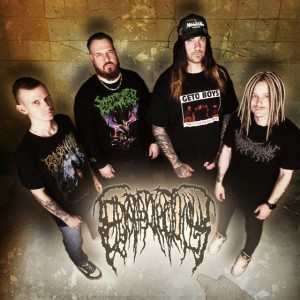 Epicardiectomy